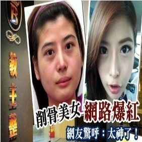 台湾削骨美女网络爆红 网友惊呼：太神了